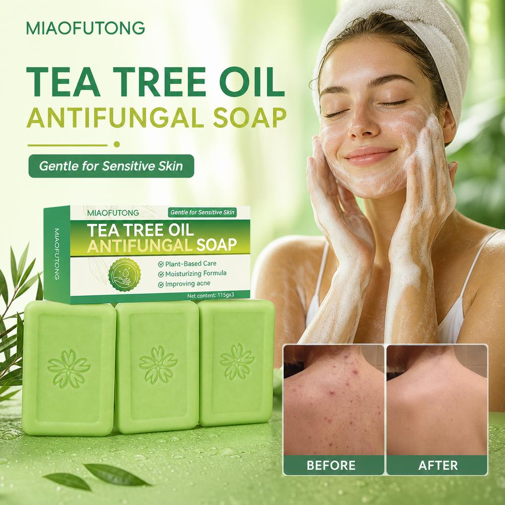 3 peças de sabonete com óleo d - Castor Oil Soap avaliação e preço
